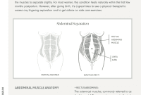 Diastasis Recti Demystified Your Complete Handbook