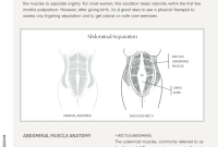 Diastasis Recti Explained: Causes, Symptoms, and Best Treatments